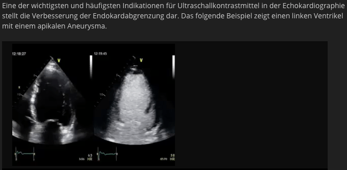 Informationen zur Kontrastechokardiographie in der klinischen Routine von Dr. Andreas Helfen
